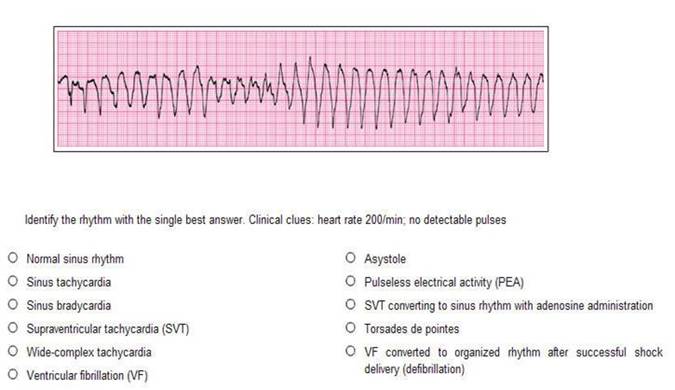 2011 Pretest American Heart Association.